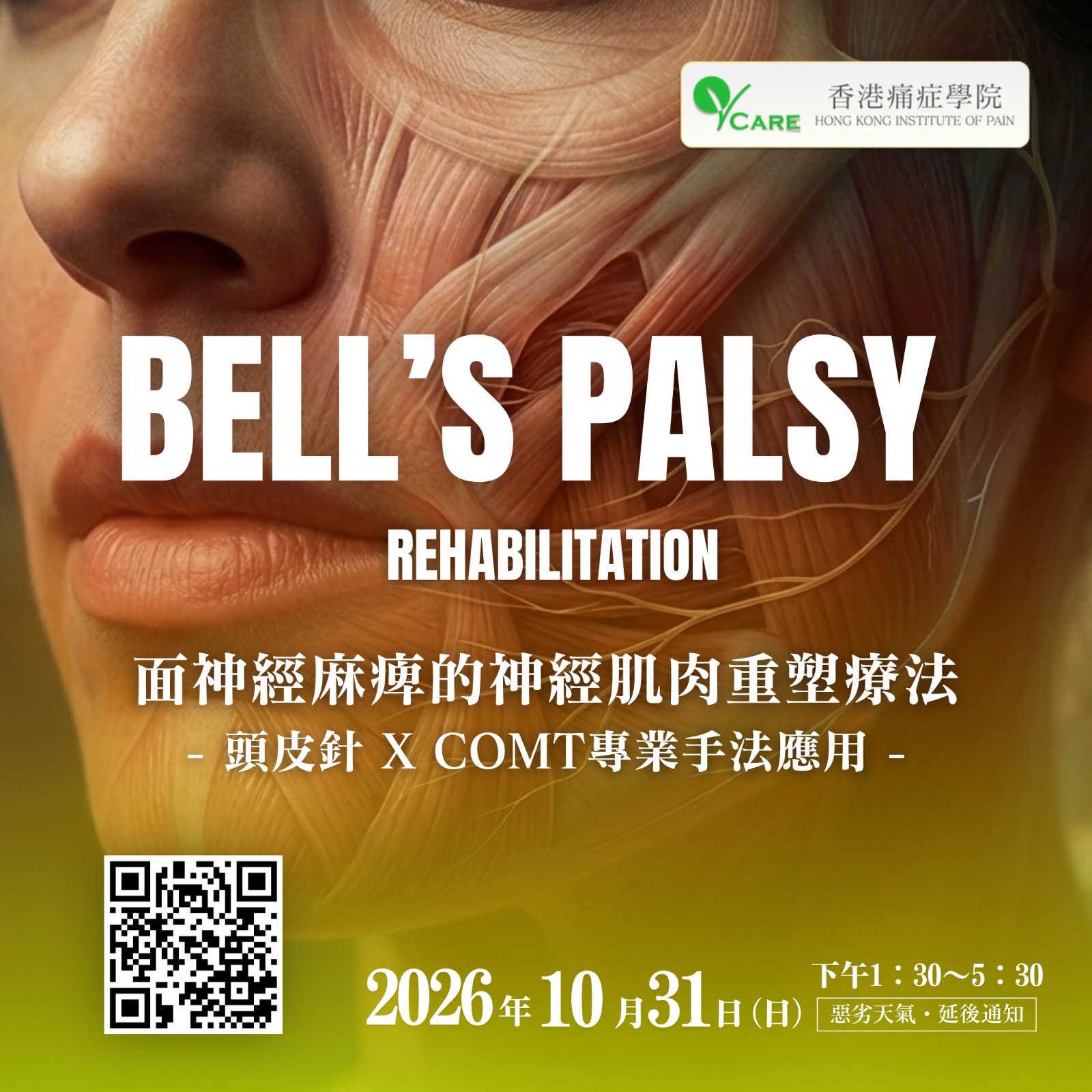 Bell's Palsy Rehabilitation 面神經麻痺的神經肌肉重塑療法（頭皮針 X COMT 專業手法應用）