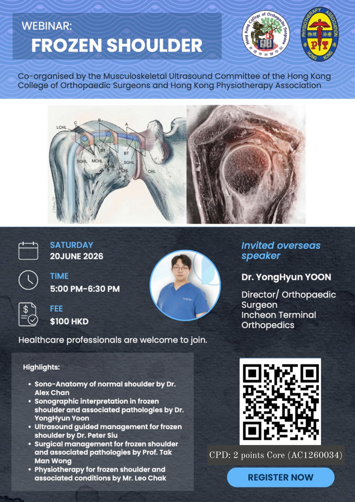 Webinar: Frozen Shoulder